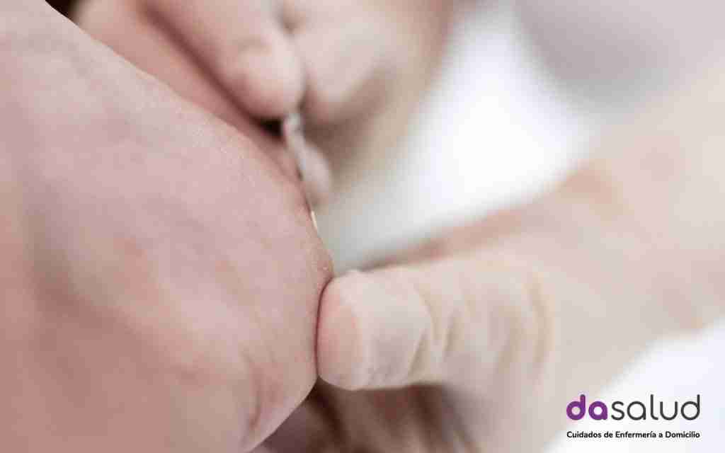 El tratamiento del papiloma plantar a domicilio