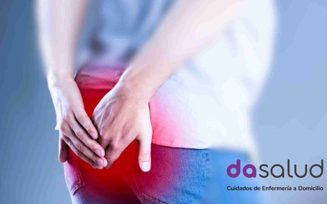 6 claves del Sinus Pilonidal: Síntomas, tratamiento y prevención
