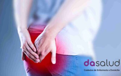6 claves del Sinus Pilonidal: Síntomas, tratamiento y prevención