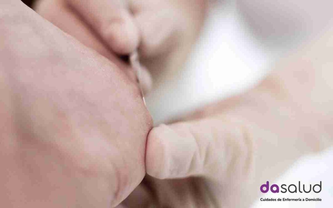El tratamiento del papiloma plantar a domicilio: 5 ventajas para el cuidado de tus pies